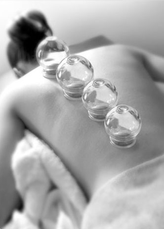cupping image